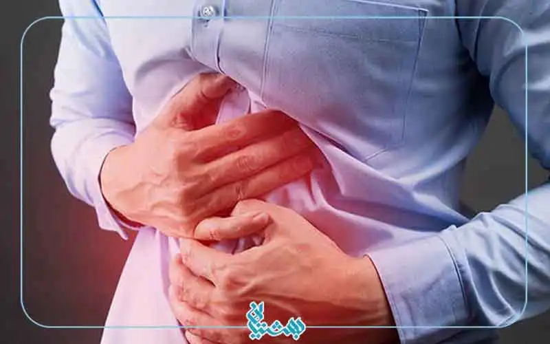 رفلاکس معده