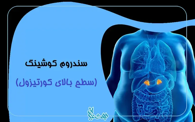 سطح کورتیزول بالا